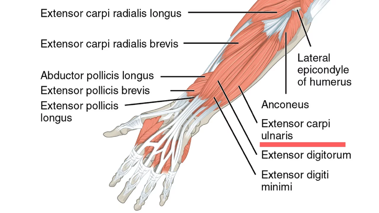 Ranteen Kyynärluun Puoleinen Ojentajalihas